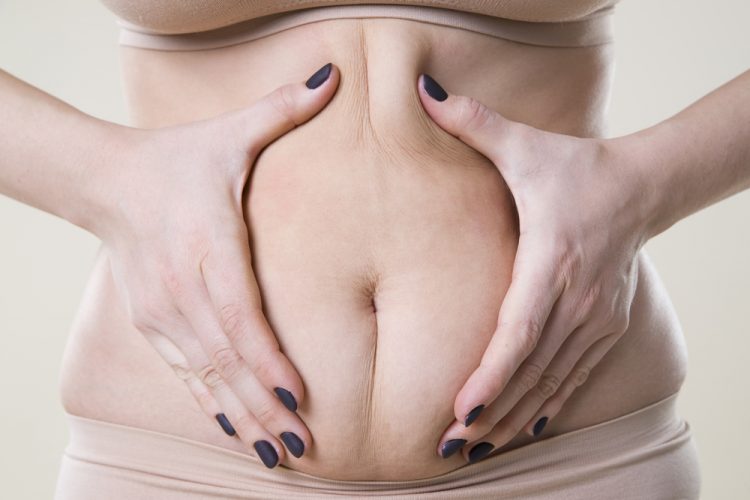 Mujer sin ningún tipo de anatomía abdominal visible